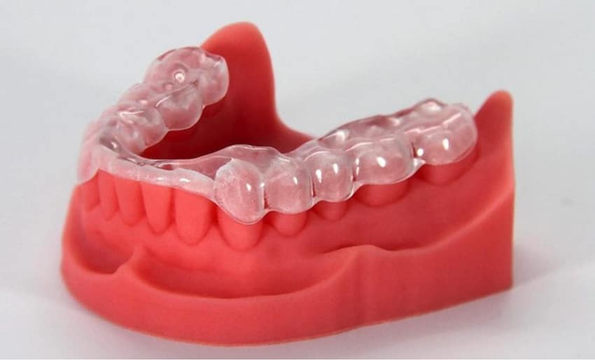 3D Clear Aligners