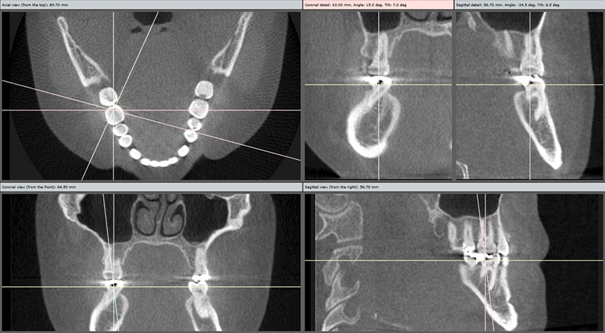 3D Dentistry Scans