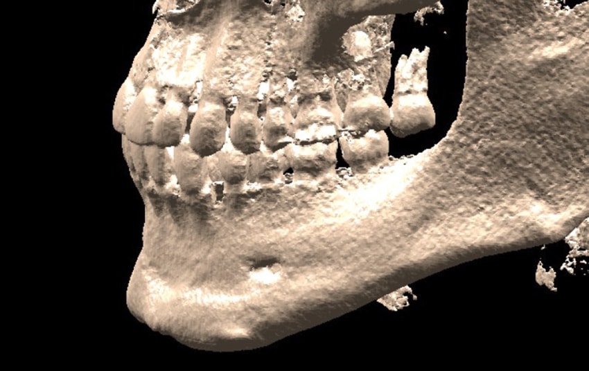 3D DICOM Example