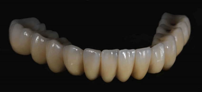 3D Milling 3D Dentistry